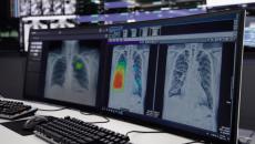 Lunit INSIGHT CXR as shown on a desktop computer Lunit INSIGHT CXR as shown on a desktop computer