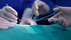 Surgeons doing surgery Surgeons doing surgery